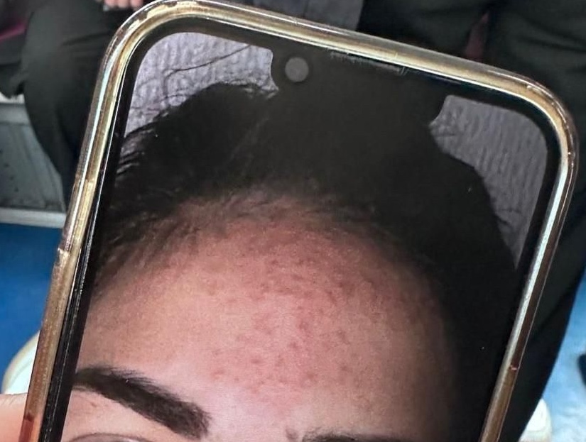 crop before